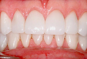 dental images 42301