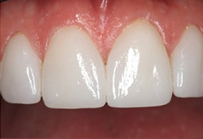 dental images 42301